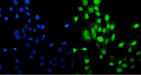3 - Anti-MCM5 Picoband™ Antibody (monoclonal, 4G10) ABO15010