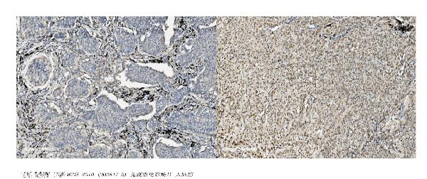 2 - Anti-MCM5 Picoband™ Antibody (monoclonal, 4G10) ABO15010
