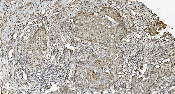 2 - Anti-MCM5 Picoband™ Antibody (monoclonal, 4G10) ABO15010