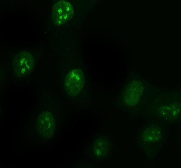 3 - Anti-DDX1 Picoband™ Antibody (monoclonal, 3I10) ABO15011