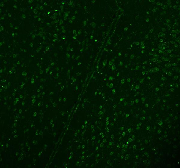 3 - Anti-DDX1 Picoband™ Antibody (monoclonal, 3I10) ABO15011