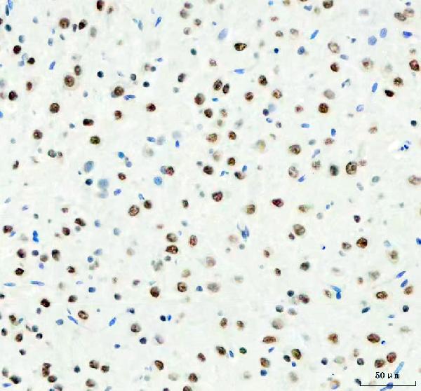 2 - Anti-DDX1 Picoband™ Antibody (monoclonal, 3I10) ABO15011