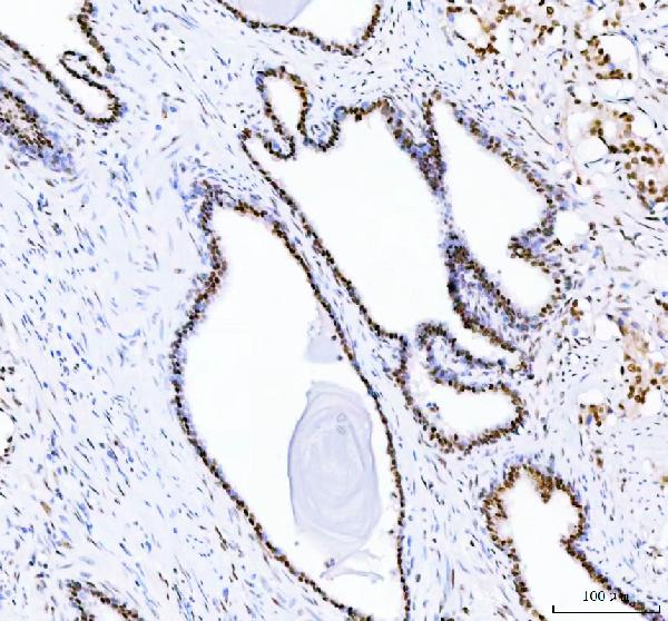 2 - Anti-DDX1 Picoband™ Antibody (monoclonal, 3I10) ABO15011