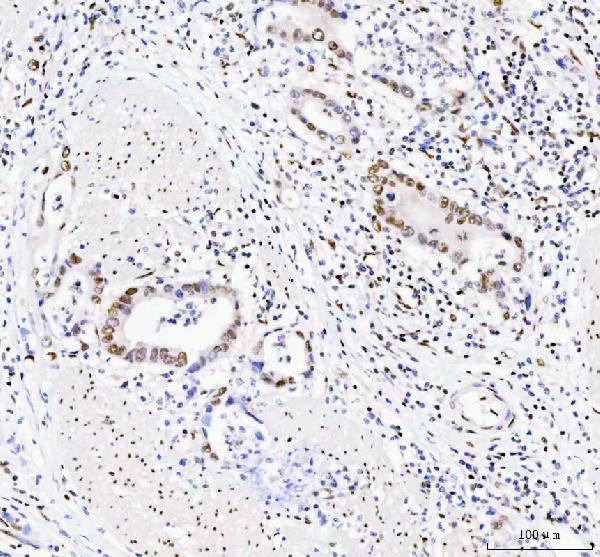 2 - Anti-DDX1 Picoband™ Antibody (monoclonal, 3I10) ABO15011