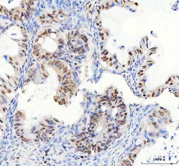 2 - Anti-DDX1 Picoband™ Antibody (monoclonal, 3I10) ABO15011