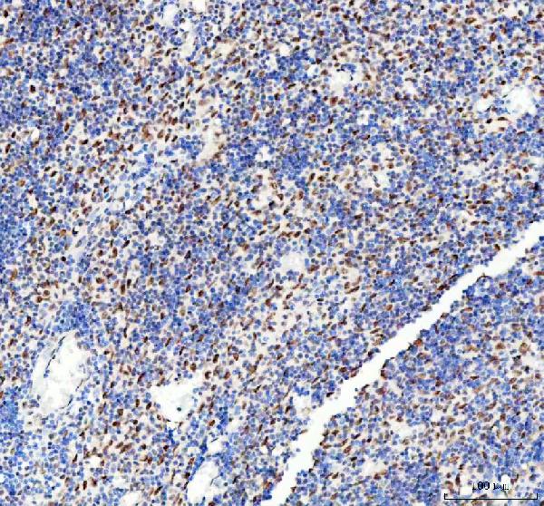 2 - Anti-DDX1 Picoband™ Antibody (monoclonal, 3I10) ABO15011