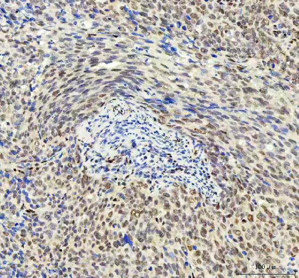 2 - Anti-DDX1 Picoband™ Antibody (monoclonal, 3I10) ABO15011