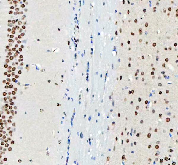 2 - Anti-DDX1 Picoband™ Antibody (monoclonal, 3I10) ABO15011