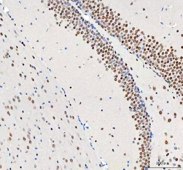 2 - Anti-DDX1 Picoband™ Antibody (monoclonal, 3I10) ABO15011