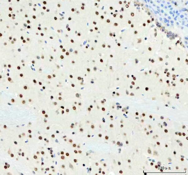 2 - Anti-DDX1 Picoband™ Antibody (monoclonal, 3I10) ABO15011