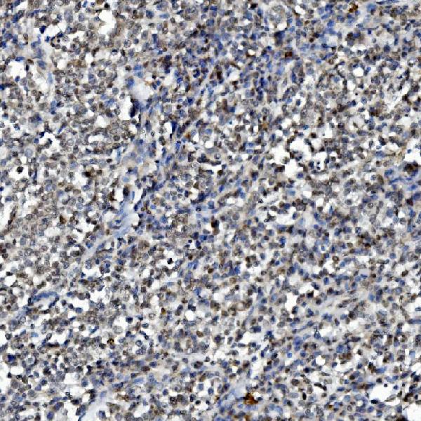 2 - Anti-DDX1 Picoband™ Antibody (monoclonal, 2D4) ABO15012