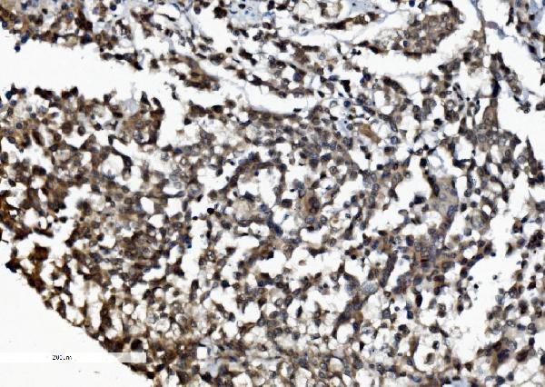 2 - Anti-DDX1 Picoband™ Antibody (monoclonal, 2D4) ABO15012