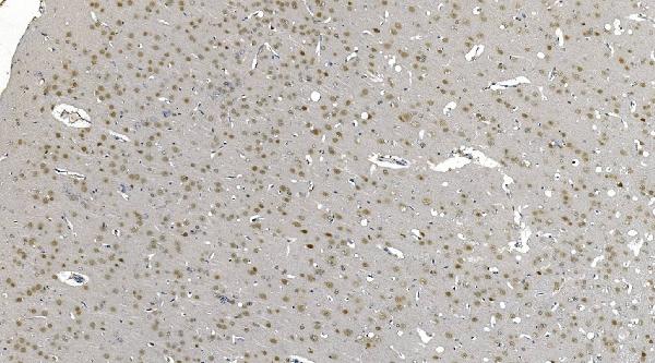 2 - Anti-DDX1 Picoband™ Antibody (monoclonal, 2D4) ABO15012