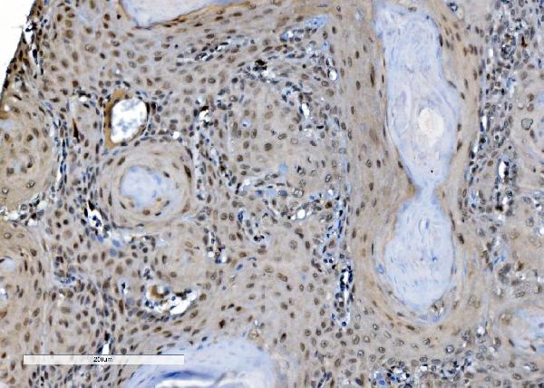 2 - Anti-DDX1 Picoband™ Antibody (monoclonal, 2D4) ABO15012