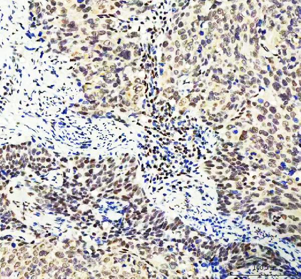 2 - Anti-DDX1 Picoband™ Antibody (monoclonal, 11E5) ABO15013