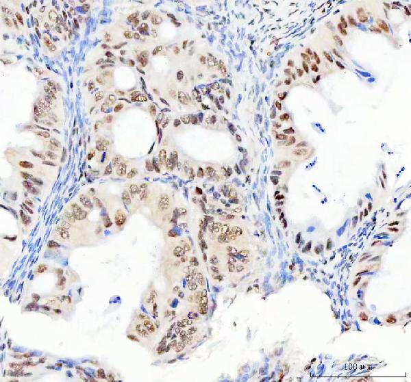 2 - Anti-DDX1 Picoband™ Antibody (monoclonal, 11E5) ABO15013