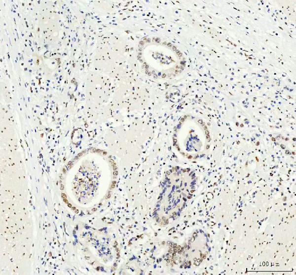 2 - Anti-DDX1 Picoband™ Antibody (monoclonal, 11E5) ABO15013