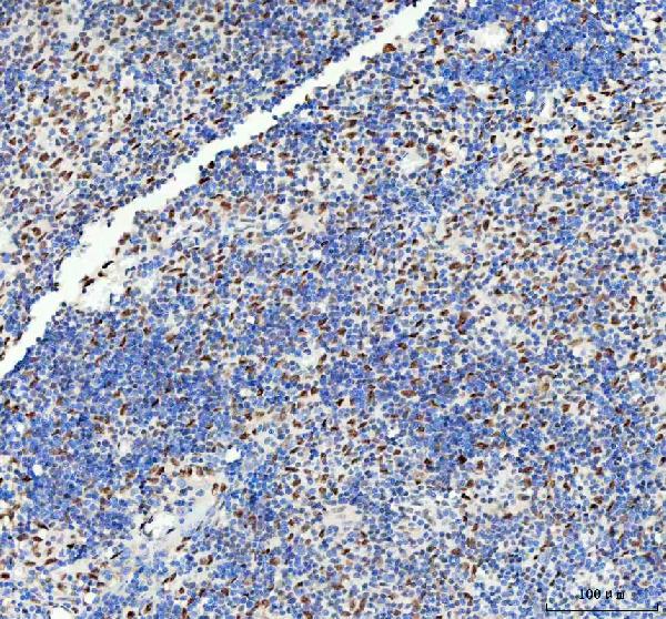 2 - Anti-DDX1 Picoband™ Antibody (monoclonal, 11E5) ABO15013
