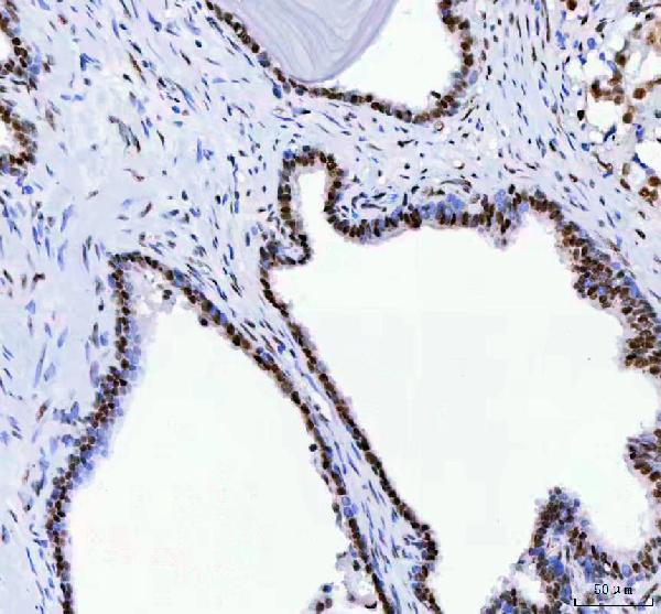 2 - Anti-DDX1 Picoband™ Antibody (monoclonal, 11E5) ABO15013