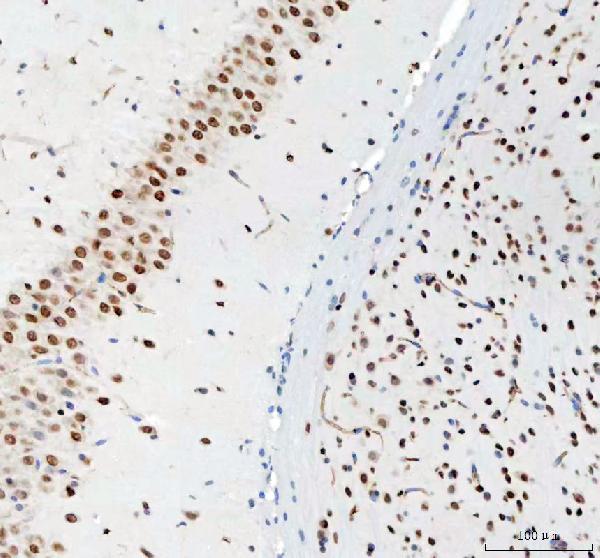 2 - Anti-DDX1 Picoband™ Antibody (monoclonal, 11E5) ABO15013