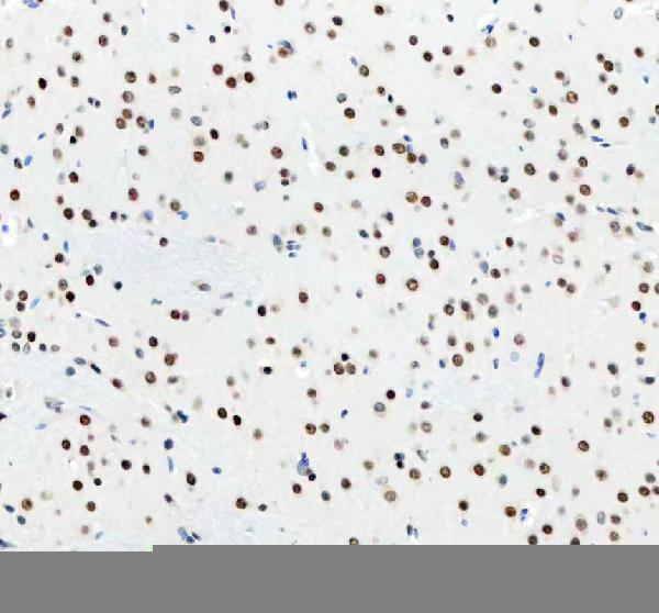 2 - Anti-DDX1 Picoband™ Antibody (monoclonal, 11E5) ABO15013