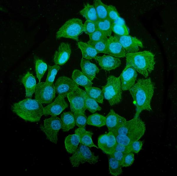 3 - Anti-Tubulin alpha Picoband™ Antibody (monoclonal, 7B12) ABO15015