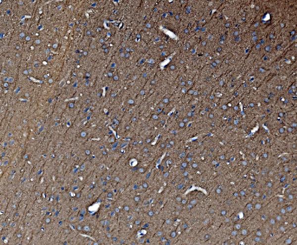 2 - Anti-Tubulin alpha Picoband™ Antibody (monoclonal, 7B12) ABO15015