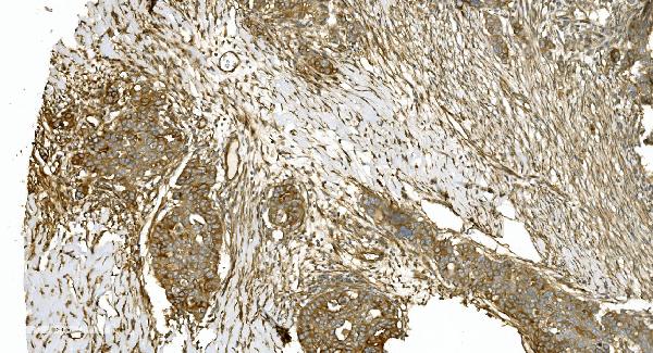 2 - Anti-Tubulin alpha Picoband™ Antibody (monoclonal, 7B12) ABO15015