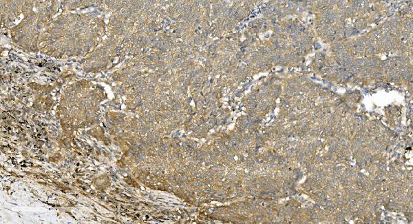 2 - Anti-Tubulin alpha Picoband™ Antibody (monoclonal, 7B12) ABO15015