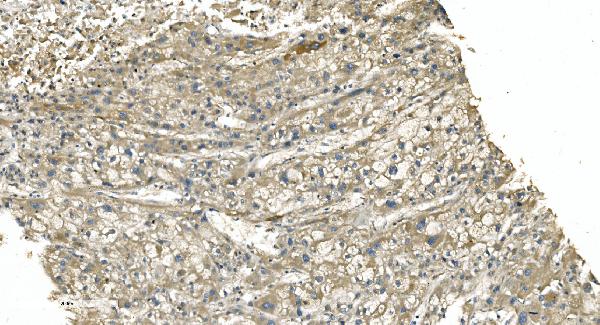 2 - Anti-Tubulin alpha Picoband™ Antibody (monoclonal, 7B12) ABO15015