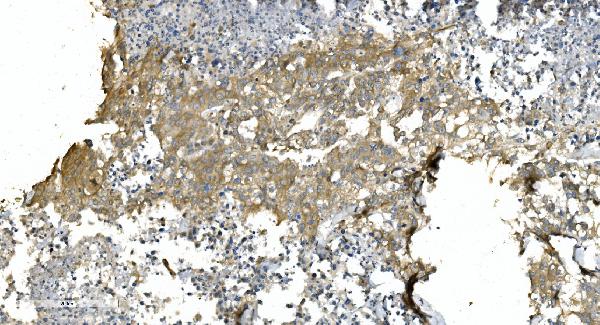 2 - Anti-Tubulin alpha Picoband™ Antibody (monoclonal, 7B12) ABO15015