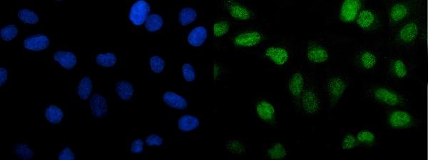 3 - Anti-PTBP2 Picoband™ Antibody (monoclonal, 8F11) ABO15016