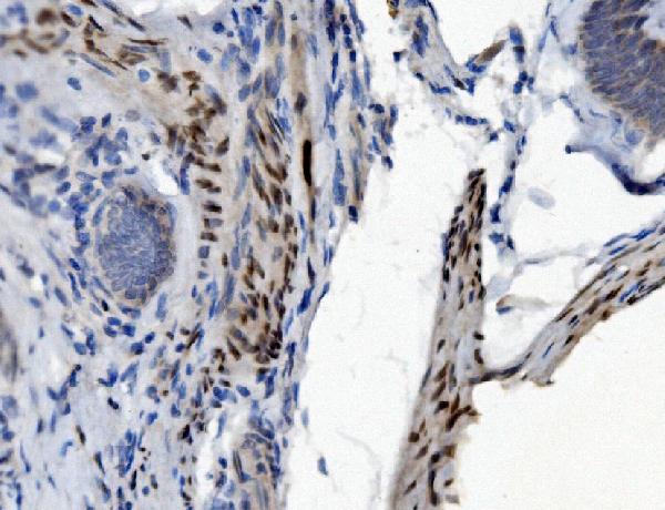 2 - Anti-PTBP2 Picoband™ Antibody (monoclonal, 8F11) ABO15016
