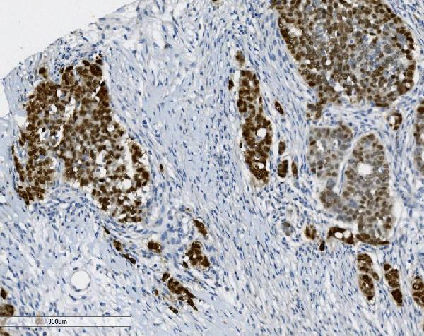 2 - Anti-PTBP2 Picoband™ Antibody (monoclonal, 8F11) ABO15016