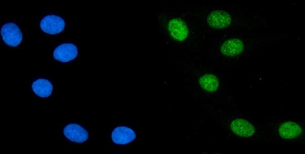 3 - Anti-PTBP2 Picoband™ Antibody (monoclonal, 13D11) ABO15017