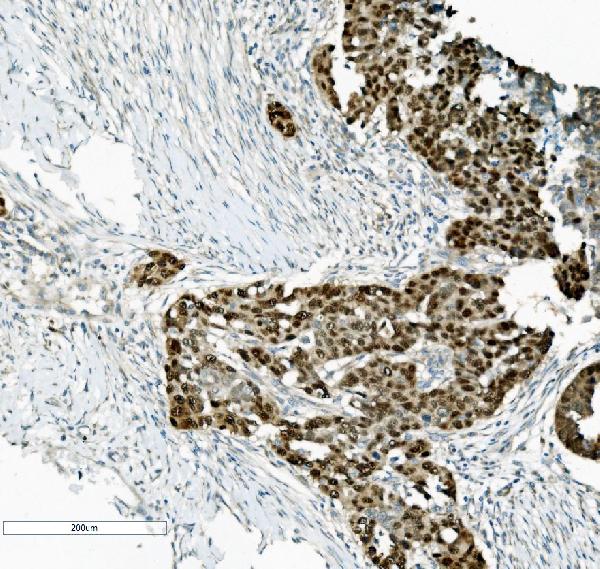 2 - Anti-PTBP2 Picoband™ Antibody (monoclonal, 13D11) ABO15017