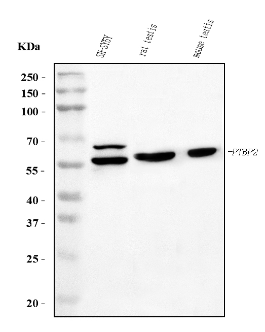 1 - Anti-PTBP2 Picoband™ Antibody (monoclonal, 13D11) ABO15017