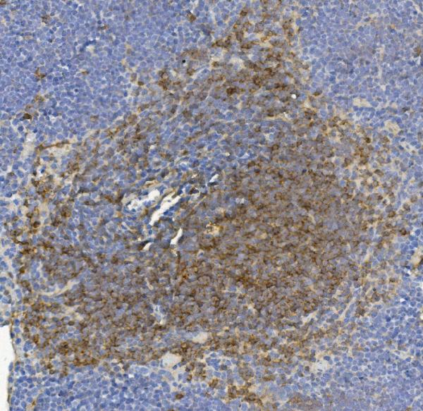 2 - Anti- IL-17F Monoclonal Antibody ABO15021
