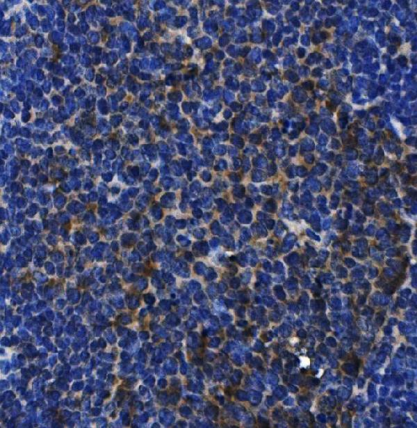 2 - Anti- IL-10 Monoclonal Antibody ABO15023