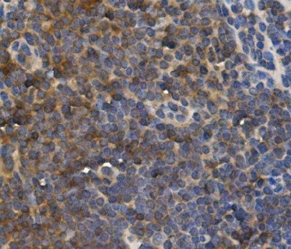 2 - Anti- IL-10 Monoclonal Antibody ABO15023
