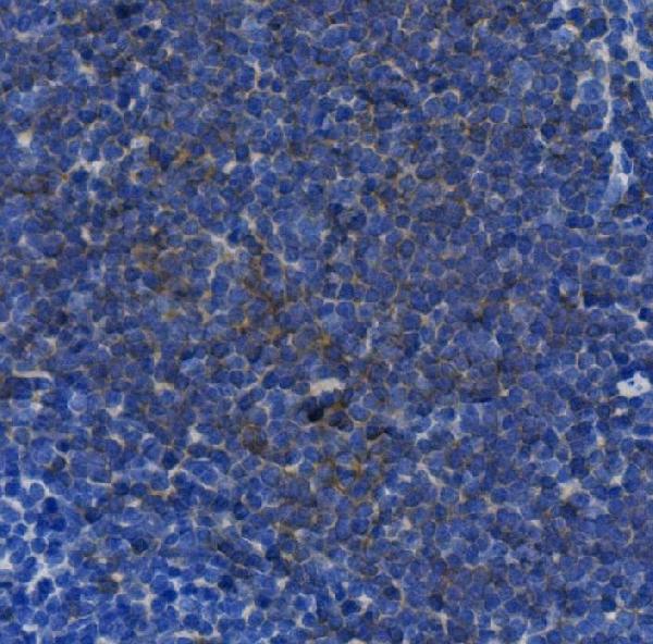 2 - Anti- IL 17A Monoclonal Antibody ABO15024