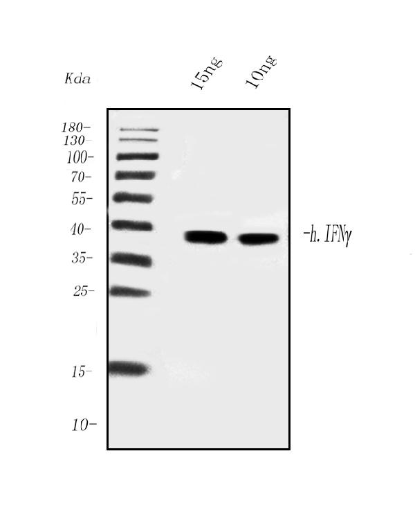 1 - Anti- IFN Gamma Monoclonal Antibody  ABO15025
