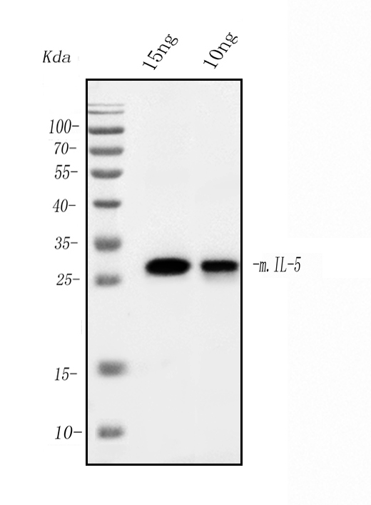 1 - Anti- IL-5 Monoclonal Antibody ABO15026