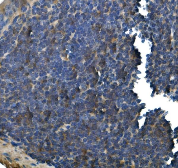 2 - Anti- IFN Gamma Monoclonal Antibody  ABO15027