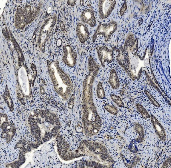 2 - Anti-SMAD2 Antibody Picoband™ (monoclonal, 3C4) ABO15030