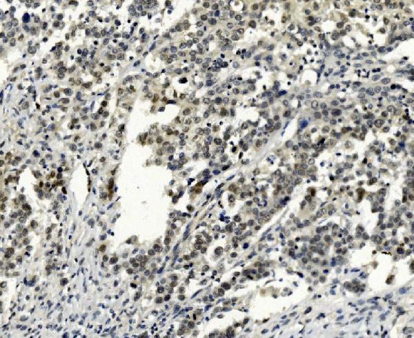 2 - Anti-SMAD2 Antibody Picoband™ (monoclonal, 3C4) ABO15030