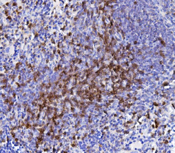 2 - Anti-CD5 Antibody Picoband™ (monoclonal, 11B4) ABO15034