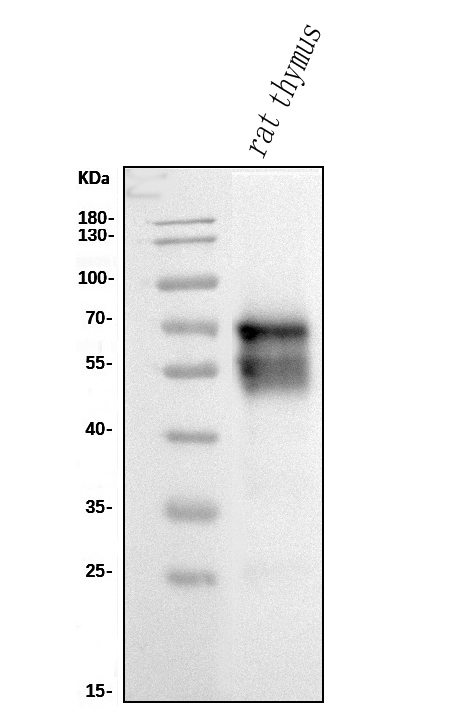 1 - Anti-CD5 Antibody Picoband™ (monoclonal, 11B4) ABO15034