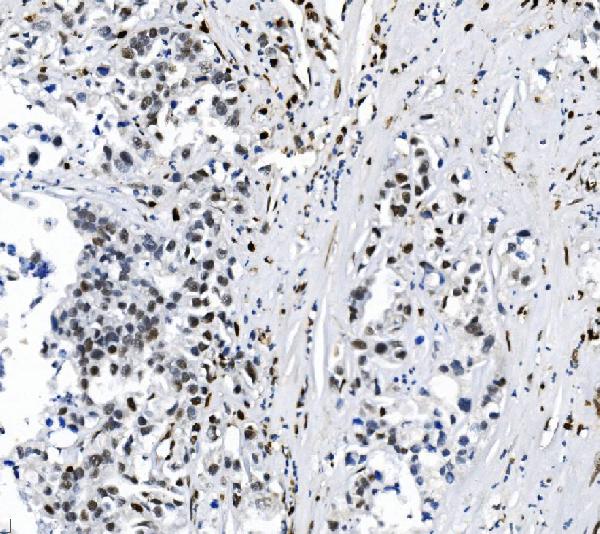 2 - Anti-SAMHD1 Antibody Picoband™ (monoclonal, 3B9) ABO15035
