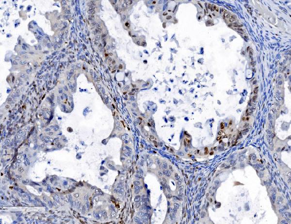 2 - Anti-SAMHD1 Antibody Picoband™ (monoclonal, 3B9) ABO15035